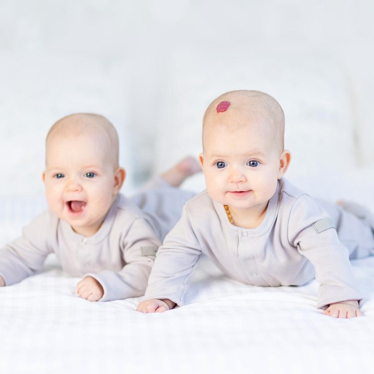 Ilustrasi hemangioma pada bayi Ilustrasi hemangioma pada bayi
