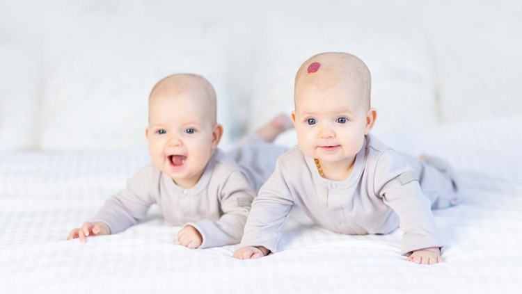 Ilustrasi hemangioma pada bayi Ilustrasi hemangioma pada bayi
