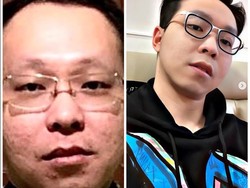 Viral Foto Aib Wajah dr. Richard Lee Sebelum Kenal Perawatan, Beda Banget!