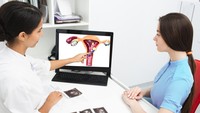 Fibroid