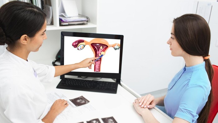 Ilustrasi fibroid dan rahim