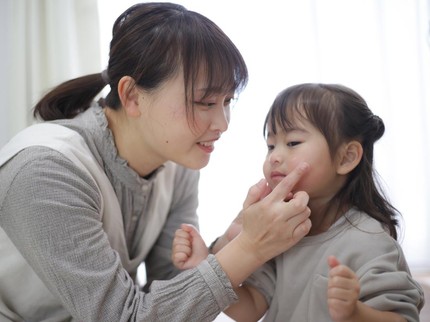 Tips Mengatasi Bercak Putih di Wajah Anak yang sering Dikira Panu