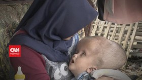 VIDEO: Perjuangan Anak Berkebutuhan Khusus - Berbuat Baik