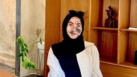 Kisah Wanita Punya Banyak Tanda Lahir Ditolak Keluarga Kekasih, Rahasiakan dari Ibunda