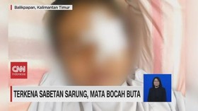 VIDEO: Terkena Sabetan Sarung, Mata Bocah Buta