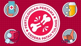 INFOGRAFIS: Pertolongan Pertama pada Kasus Patah Tulang