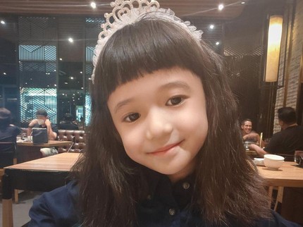 Ngilu! Anting Menancap ke Kulit hingga Berdarah, Putri Nycta Gina Dilarikan ke Dokter