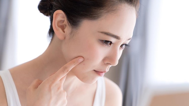Ilustrasi bekas jerawat atau skincare Ilustrasi bekas jerawat atau skincare