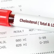 10 Minuman untuk Menurunkan Kolesterol yang Naik Usai Lebaran