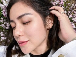 Jessica Iskandar Pamer Hidung Oplas, Disebut Mirip Nikita Mirzani