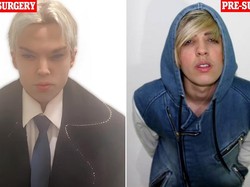 Aktor Ini Meninggal Usai 12 Kali Operasi Plastik Demi Mirip Jimin BTS