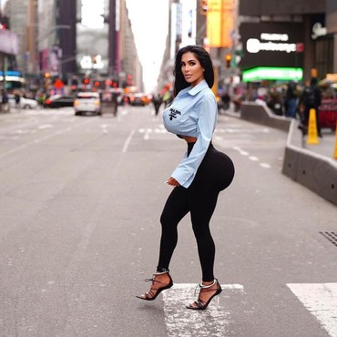 Sekarat Usai Jalani Prosedur Medis, Kim Kardashian KW Meninggal Dunia