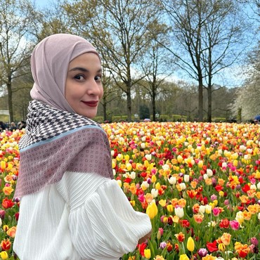 Irwansyah Jatuh saat Berkuda, Shireen Sungkar Ungkap Kondisi Terkini Kakak Ipar