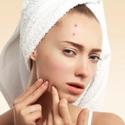 5 Alasan yang Menjadi Penyebab Jerawat di Wajah Susah Hilang, Kamu Wajib Tahu!