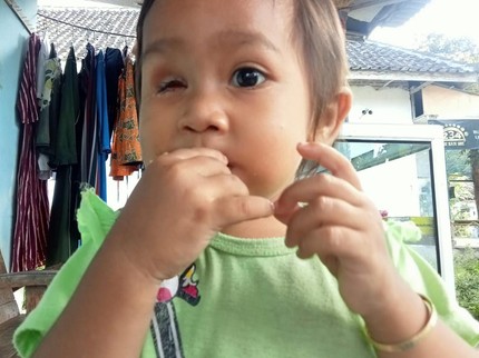 Kisah Sedih Anak Petani Usia 3 Tahun yang Kehilangan Bola Mata Akibat Kanker