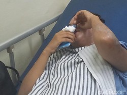 Wajah Wanita di Palembang Melepuh Disiram Air Keras oleh OTK