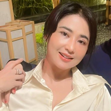 Lakukan Transfer Lemak di Wajah, Dewi Perssik Bantah Operasi Plastik