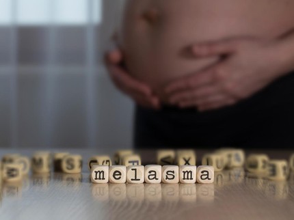 Melasma saat Hamil: Penyebab dan Cara Mengatasi Kulit Hitam saat Hamil