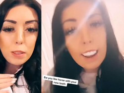 Viral Bayar Rp 73 Juta buat Veneer Gigi, Endingnya Malah Begini