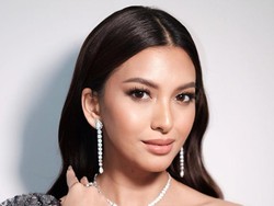 Alisia Rininta Alami Cedera Otot Usai Adegan Menari, Begini Kondisinya