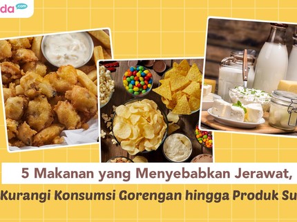 5 Makanan yang Menyebabkan Jerawat, Kurangi Konsumsi Gorengan hingga Produk Susu