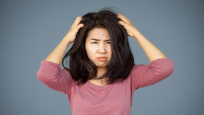 3 Cara Mudah Mengatasi Ketombe Untuk Bunda Yang Banyak Melakukan Aktivitas Outdoor