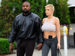 Wow, Kanye West Pasang Titanium di Gigi Seharga Rp 13,2 M