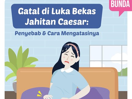 Gatal di Luka Bekas Jahitan Caesar: Penyebab & Cara Mengatasinya