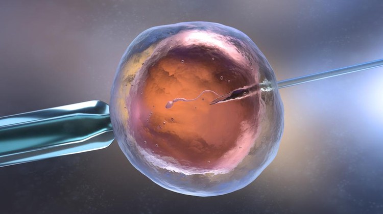 Inseminasi Buatan
