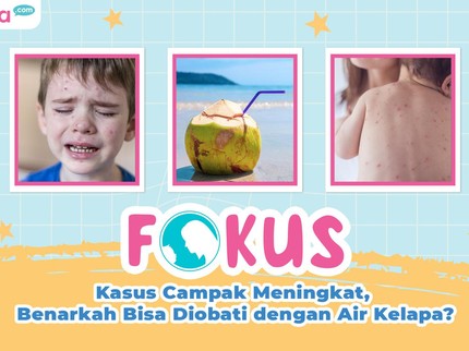 Kasus Campak Meningkat, Benarkah Bisa Diobati dengan Air Kelapa?