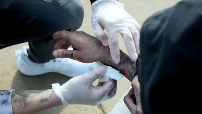 Wabah narkotika 'zombie' di Amerika Serikat