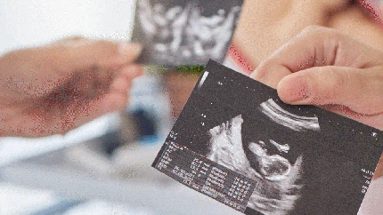 Tanda Janin 4 Bulan Sehat dalam Kandungan & Penyebab Perut Masih Kecil