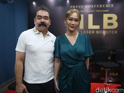 Inul Daratista Jelaskan soal Heboh Disebut Tante Poppy Capella