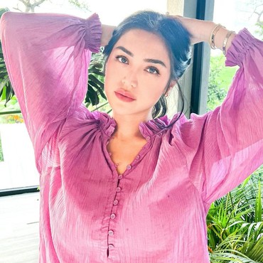 Pesan Haru Anak untuk Jessica Iskandar yang Operasi Plastik Hidung