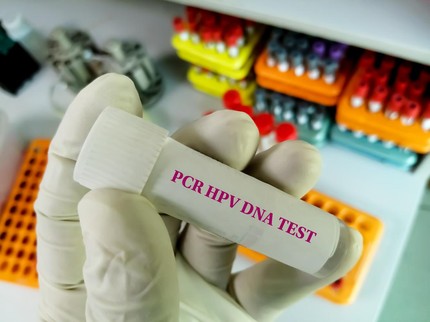 Skrining Kanker Serviks dengan HPV DNA Gratis di Jakarta, Bunda di Atas 30 Tahun Perlu Tahu