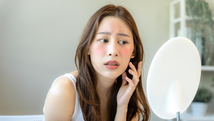 1488361550 Beautiful Asian women are worried about faces allergic to chemicals in cosmetics. red face from sunburn, sensitive skin, allergic to steroids