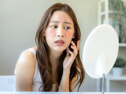 Wajah Alergi Sunscreen? Kenali Ciri, Penyebab, dan Cara Mengatasinya