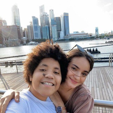 Beda Ayah, 8 Potret Enzy Storia & Casey Sang Adik yang Dinilai Tak Mirip