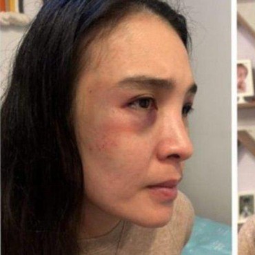 Ayah Putri Balqis Beberkan Kekejaman Bani Idham Lakukan KDRT