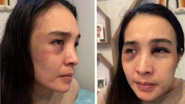 img-title Ayah Putri Balqis Beberkan Kekejaman Bani Idham Lakukan KDRT