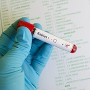 Apa Benar Orang Terkena Rabies Jadi Takut Air? Cek Faktanya di Sini!