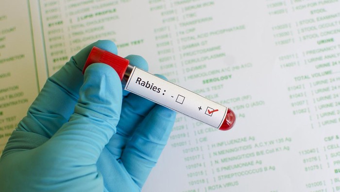 Apa Benar Orang Terkena Rabies Jadi Takut Air? Cek Faktanya di Sini!