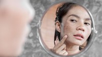 5 Cara Mudah Menghilangkan Flek Hitam di Wajah, Bikin Tambah Percaya Diri Bun!