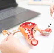 Skrining Kanker Serviks Digratiskan Pemerintah, Seperti Inilah Metodenya!