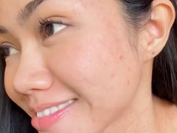 Gaya Yura Yunita Percaya Diri Pamer Wajah Berjerawat dan Ketiak Tak Mulus