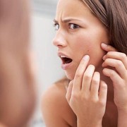 5 Tips Menghilangkan Jerawat Secara Alami dan Mencegahnya Muncul Kembali