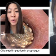 Viral di TikTok, Dokter Jelaskan Cara Konsumsi Chia Seed yang Benar, Ini Akibatnya Kalau Salah Konsumsi!