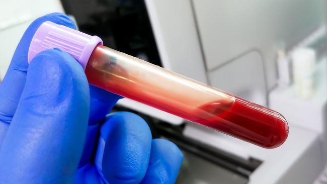 Baru-baru ini berkembang tren kecantikan di China yang dikenal sebagai "blood purification" atau terapi pemurnian darah yang diklaim bisa memperpanjang umur.