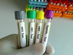 Optimalkan Komunitas Jadi Upaya Pemkab Sumedang Wujudkan Bebas HIV