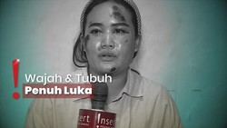 Malang Nasib Ambar Ditabrak Pacar Gegara Lambaian Tangan Pria Lain